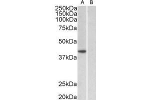 ABIN987280 (1µg/ml) staining of HeLa nuclear (A) and cytosolic (B) lysates (35µg protein in RIPA buffer). (TBP 抗体  (AA 39-50))