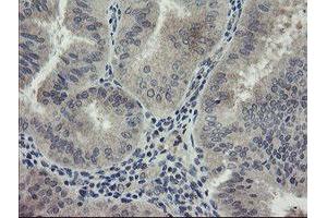 Image no. 8 for anti-rho GTPase Activating Protein 2 (ARHGAP2) antibody (ABIN1499627)