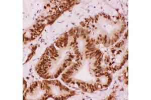 Immunohistochemistry (IHC) image for anti-Activating Transcription Factor 2 (ATF2) (AA 93-450) antibody (ABIN3043791)