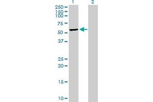 Western Blot analysis of MLKL expression in transfected 293T cell line by MLKL MaxPab polyclonal antibody. (MLKL 抗体  (AA 1-471))