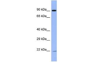 Host:  Rabbit  Target Name:  ZNF780B  Sample Type:  ACHN Whole cell lysates  Antibody Dilution:  1. (ZNF780B 抗体  (N-Term))