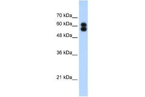 WB Suggested Anti-ALPP Antibody Titration:  1. (PLAP 抗体  (C-Term))