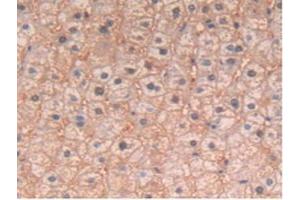 IHC-P analysis of Human Liver Tissue, with DAB staining. (IL-4 抗体)