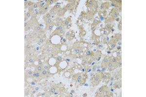 Immunohistochemistry of paraffin-embedded human liver injury using CHMP1B antibody at dilution of 1:100 (x40 lens). (CHMP1B 抗体)
