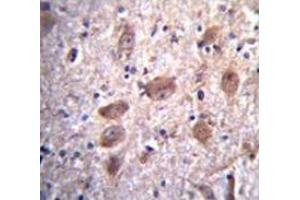Immunohistochemistry analysis in human brain tissue (Formalin-fixed, Paraffin-embedded) using Paraplegin / SPG7  Antibody , followed by peroxidase conjugation of the secondary antibody and DAB staining. (SPG7 抗体  (Middle Region))