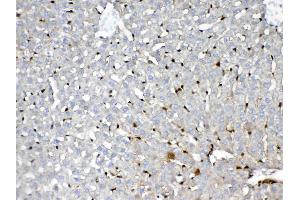 Immunohistochemistry (IHC) image for anti-Glutathione S-Transferase pi 1 (GSTP1) (AA 2-210) antibody (ABIN5518996)