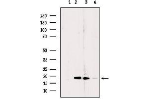 Western blot analysis of extracts from various samples, using RPL24 Antibody. (RPL24 抗体  (Internal Region))