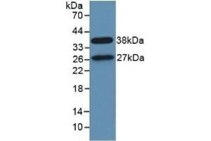 Detection of Recombinant STAM1, Human using Polyclonal Antibody to Signal Transducing Adaptor Molecule 1 (STAM1) (STAM 抗体  (AA 196-465))