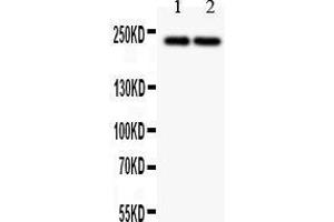 Western Blotting (WB) image for anti-Dicer 1, Ribonuclease Type III (DICER1) (AA 1-195) antibody (ABIN3043347) (DICER1 抗体  (AA 1-195))