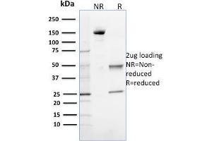SDS-PAGE Analysis Purified 8-oxoguanine Mouse Monoclonal Antibody (CPTC-OGG1-1). (OGG1 抗体)