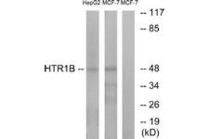 Western blot analysis of extracts from HepG2/MCF-7 cells, using HTR1B Antibody. (5HT1B Receptor 抗体  (AA 261-310))