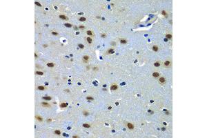 Immunohistochemistry of paraffin-embedded rat brain using PAX7 antibody at dilution of 1:100 (x40 lens). (PAX7 抗体)