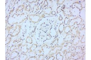 Paraformaldehyde-fixed, paraffin embedded human kidney, Antigen retrieval by boiling in sodium citrate buffer (pH6) for 15min, Block endogenous peroxidase by 3% hydrogen peroxide for 30 minutes, Blocking buffer (normal goat serum) at 37°C for 20min, Antibody incubation with Rabbit Anti-CD244 Polyclonal Antibody, Unconjugated  at 1:200 overnight at 4°C, followed by a conjugated secondary for 90 minutes and DAB staining. (2B4 抗体  (AA 151-250))