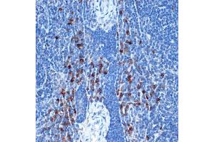 Immunohistochemistry of paraffin-embedded mouse spleen using NAIP Rabbit mAb (ABIN7268931) at dilution of 1:100 (40x lens). (NAIP 抗体)