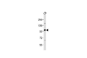 Anti-EZH2 Antibody at 1:1000 dilution + C6 whole cell lysates Lysates/proteins at 20 μg per lane. (EZH2 抗体  (AA 410-440))