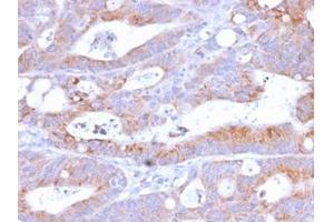 Formalin-fixed, paraffin-embedded human Colon stained with CD86 Rabbit Recombinant Monoclonal Antibody (C86/2160R). (Recombinant CD86 抗体)