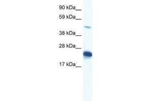 Western Blotting (WB) image for anti-Zinc Finger Protein 57 Homolog (ZFP57) antibody (ABIN2460341) (ZFP57 抗体)