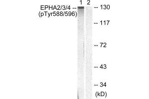 Western Blotting (WB) image for anti-Eph Receptor A2+A3 (EPHA2/3) (pTyr588), (pTyr596) antibody (ABIN1847362)