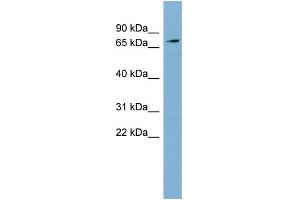 WB Suggested Anti-SLC7A2 Antibody Titration:  0. (SLC7A2 抗体  (Middle Region))