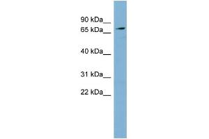 Western Blotting (WB) image for anti-Solute Carrier Family 7 (Cationic Amino Acid Transporter, Y+ System), Member 2 (SLC7A2) (Middle Region) antibody (ABIN2781551)
