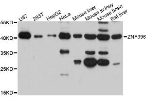 Western blot analysis of extracts of various cell lines, using ZNF396 antibody (ABIN6291098) at 1:3000 dilution. (ZNF396 抗体)