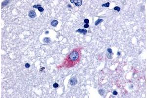 Anti-LGR4 antibody  ABIN1049003 IHC staining of human brain, neurons and glia. (LGR4 抗体  (Cytoplasmic Domain))