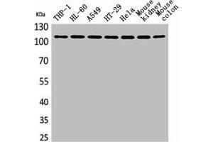 Western Blot analysis of THP-1 H460 A549 HT29 HeLa mouse kidney mouse colon cells using cPLA2 Polyclonal Antibody (PLA2G4A 抗体  (N-Term))