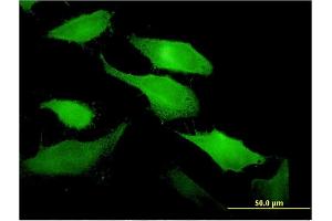 Immunofluorescence (IF) image for anti-Tumor Necrosis Factor (Ligand) Superfamily, Member 11 (TNFSF11) (AA 222-316) antibody (ABIN522063)