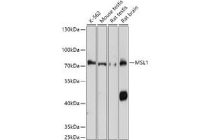 Western blot analysis of extracts of various cell lines, using MSL1 antibody (ABIN7268383) at 1:1000 dilution.
