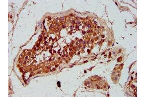 IHC image of ABIN7154448 diluted at 1:300 and staining in paraffin-embedded human testis tissue performed on a Leica BondTM system. (GREM1 抗体  (AA 18-184))