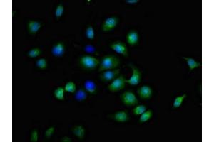 Immunofluorescence (IF) image for anti-Tumor Necrosis Factor Receptor Superfamily, Member 9 (TNFRSF9) (AA 24-186) antibody (ABIN7173895)