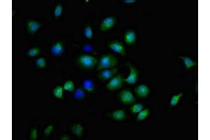 Immunofluorescent analysis of A549 cells using ABIN7173895 at dilution of 1:100 and Alexa Fluor 488-congugated AffiniPure Goat Anti-Rabbit IgG(H+L)
