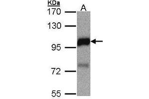 WB Image Sample(30 μg of whole cell lysate) A:MOLT4, 7. (DLC1 抗体  (N-Term))