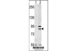 Western blot analysis of BRD2 using rabbit polyclonal BRD2 Antibody using 293 cell lysates (2 ug/lane) either nontransfected (Lane 1) or transiently transfected with the BRD2 gene (Lane 2). (BRD2 抗体  (AA 170-200))