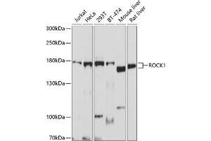Western blot analysis of extracts of various cell lines, using ROCK1 antibody  at 1:1000 dilution. (ROCK1 抗体)
