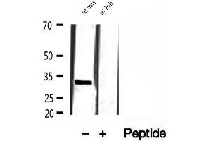 Western blot analysis of extracts of rat brain tissue, using SULT4A1 antibody. (SULT4A1 抗体  (C-Term))