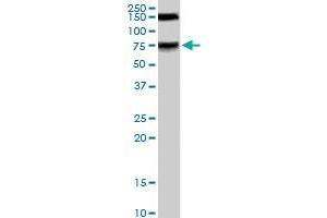 MELK polyclonal antibody  staining (0. (MELK 抗体)