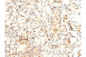ABIN6267072 at 1/100 staining mouse lung tissue sections by IHC-P. (JAK1 抗体  (pTyr1022, pTyr1023))