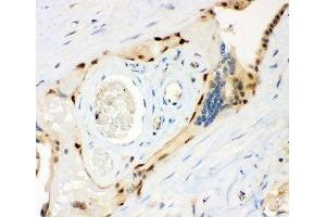 IHC-P: MSK1 antibody testing of human placenta tissue (MSK1 抗体  (AA 540-665))