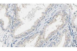 ABIN6267468 at 1/100 staining Human prostate tissue by IHC-P. (CDC25B 抗体  (pSer353))