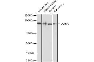 Western blot analysis of extracts of various cell lines, using L Rabbit mAb  at 1:1000 dilution. (LAMP2 抗体)