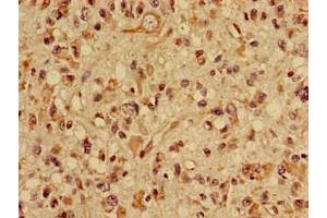 Immunohistochemistry (IHC) image for anti-Solute Carrier Family 22 (Organic Cation Transporter), Member 2 (SLC22A2) (AA 48-135) antibody (ABIN7170144)