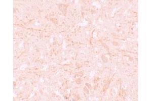 Immunohistochemical staining of human brain cells with NLRP12 polyclonal antibody  at 5 ug/mL.