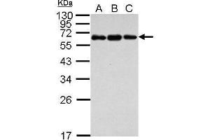 WB Image Sample (30 ug of whole cell lysate) A: Jurkat B: Raji C: K562 12% SDS PAGE antibody diluted at 1:1000 (C4BPB 抗体)