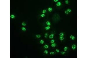 Anti-MGLL mouse monoclonal antibody (ABIN2454694) immunofluorescent staining of COS7 cells transiently transfected by pCMV6-ENTRY MGLL (RC218358). (MGLL 抗体)