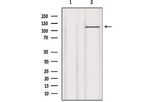 Western Blotting (WB) image for anti-Cas-Br-M (Murine) Ecotropic Retroviral Transforming Sequence (CBL) (Internal Region) antibody (ABIN6260513)