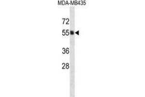 Western blot analysis in MDA-MB435 cell line lysates (35ug/lane) using PIGA  Antibody . (PIGA 抗体  (C-Term))