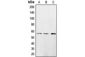 Western blot analysis of CaMK2 delta expression in HeLa (A), A431 (B), H1299 (C) whole cell lysates. (CAMK2D 抗体  (Center))