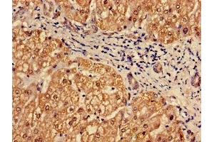 Immunohistochemistry of paraffin-embedded human liver tissue using ABIN7164964 at dilution of 1:100
