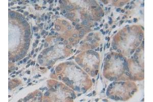 DAB staining on IHC-P; Samples: Human Stomach Tissue (IL20RB 抗体  (AA 37-290))